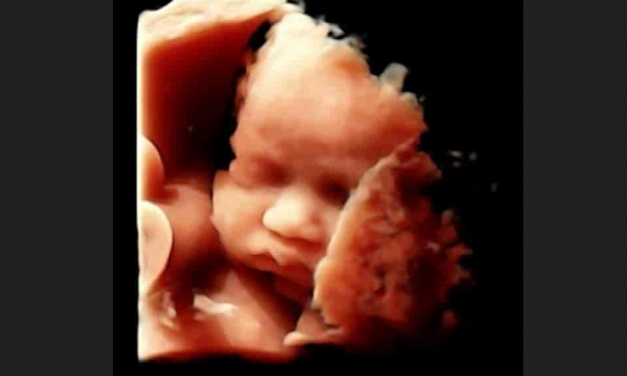 Abortionist Admits Abortions Kill Babies: “We are the Executioners”