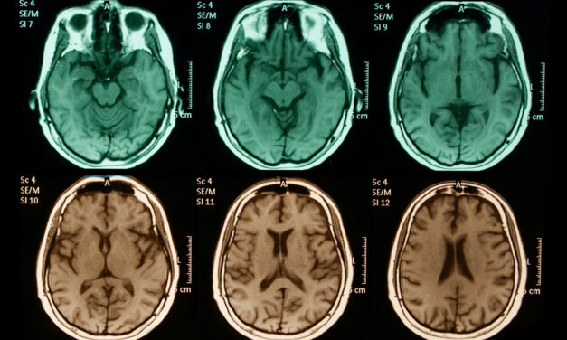 Groundbreaking Neuroscience Study Finds Striking Similarities in Brains of Porn and Drug Addicts