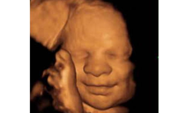 Pro-Life Group Launches Campaign in 26 States to Save Babies From Abortion